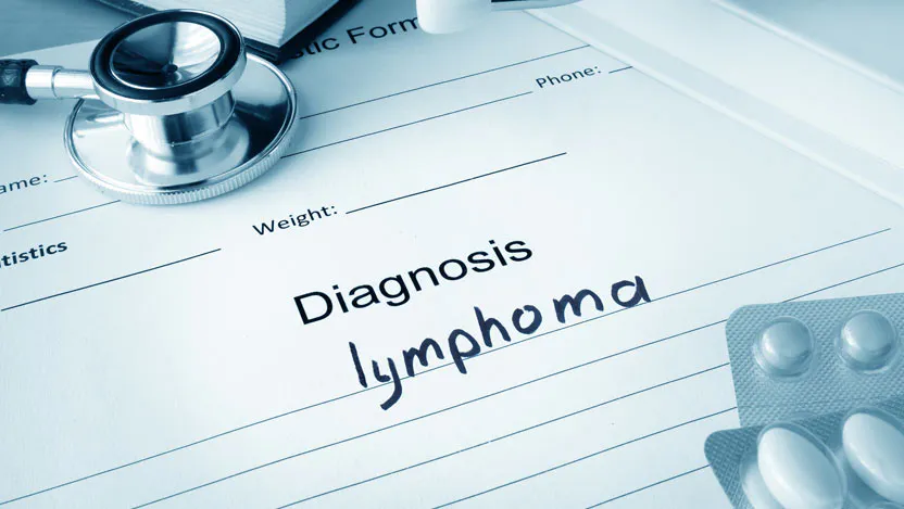 lymphoma diagnosis