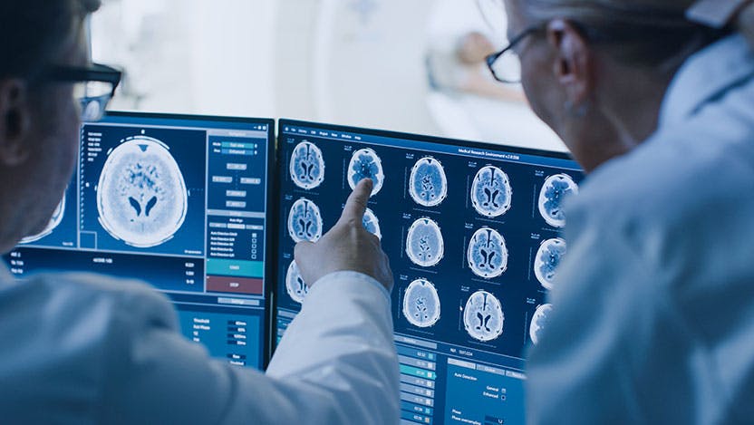 Doctors looking at images of brain scans 