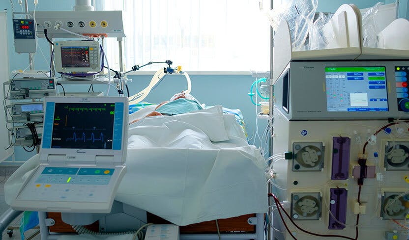 Emergency patient in critical state with intraaortic balloon pump and extracorporeal circuit hemodialysis assist.