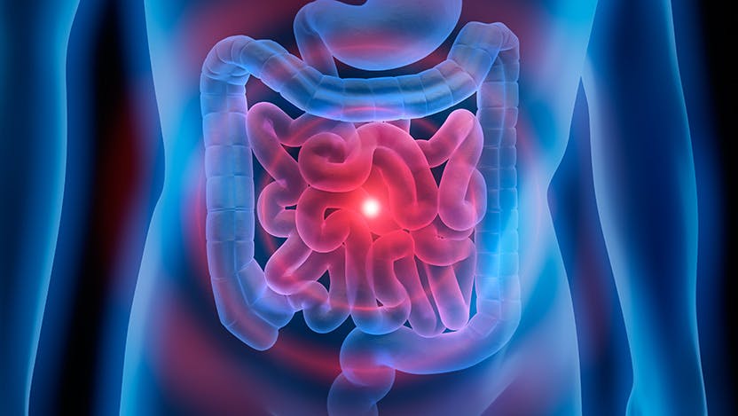 Research shows gut bacteria affects radiotherapy in cancer